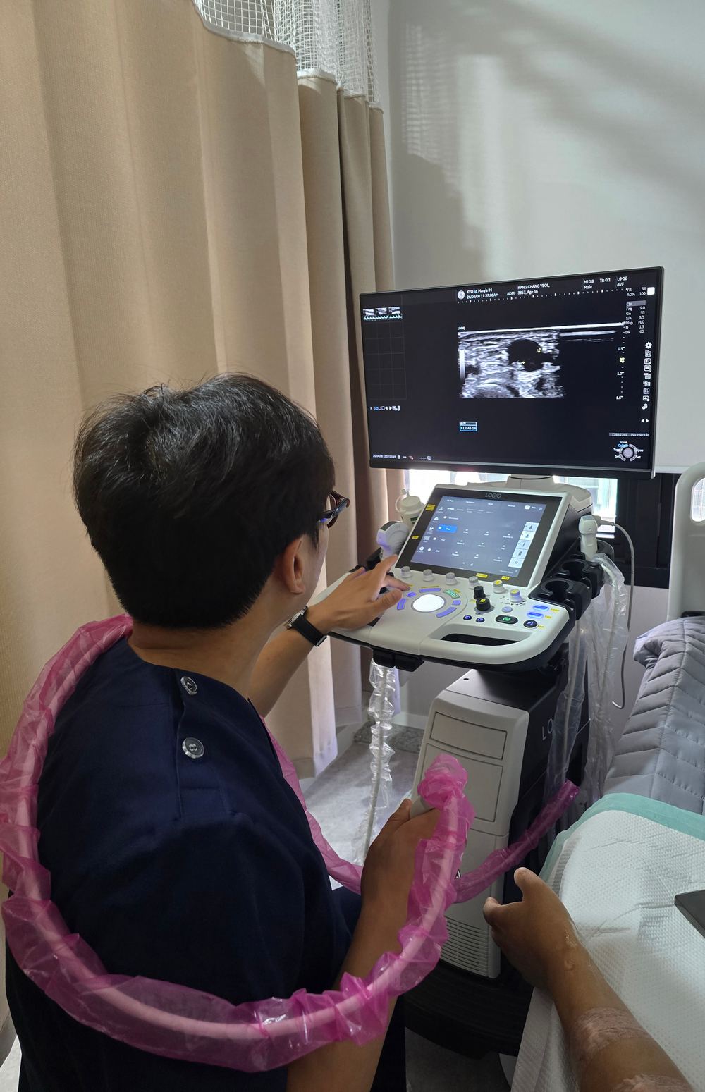 혈관초음파 검사